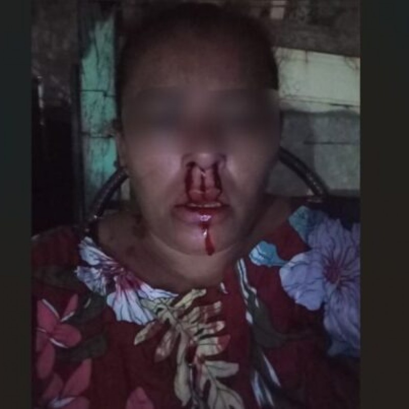 Mulher � brutalmente espancada por primo ao tentar intervir em caso de viol�ncia contra outra mulher em Patos